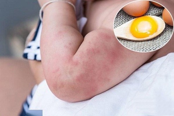 Một số lưu ý khi ăn trứng gà